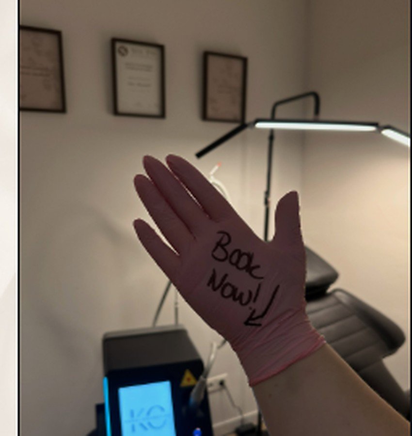 Laser removal
